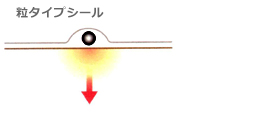 耳つぼ 粒タイプシール